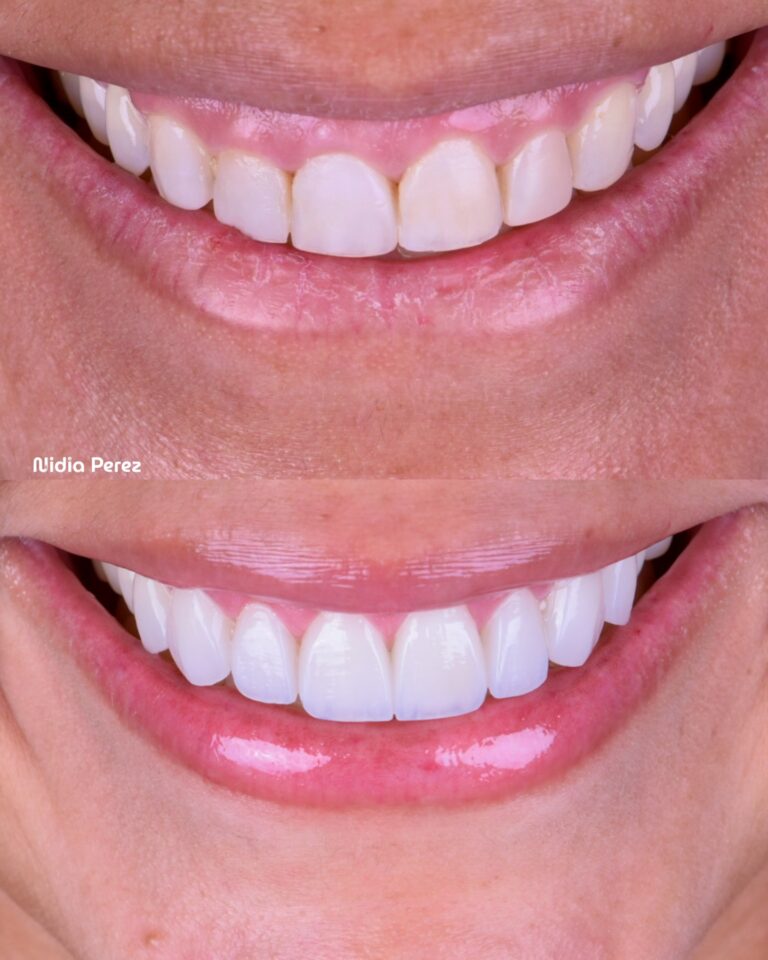 Instagram post from nidiaperezodontologa. This post is in position 1.