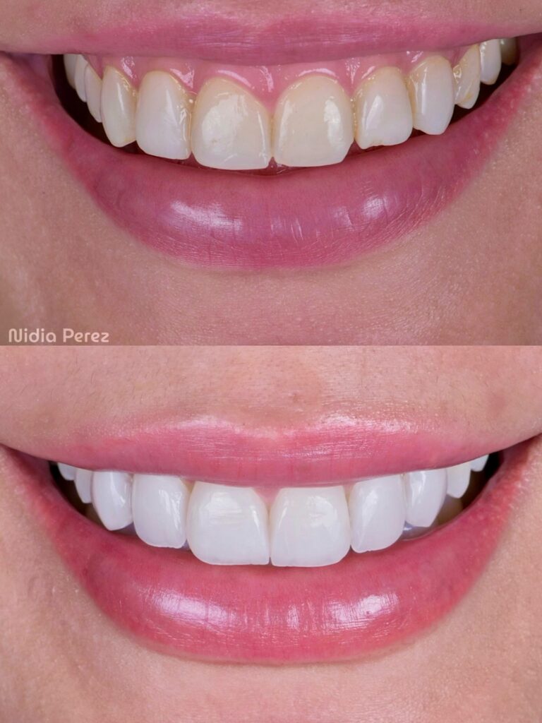 Instagram post from nidiaperezodontologa. This post is in position 1.