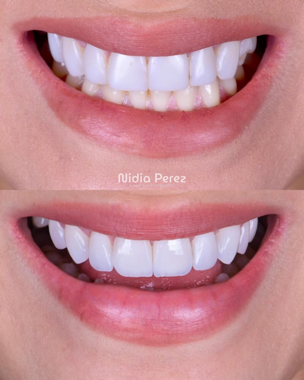 Instagram post from nidiaperezodontologa. This post is in position 4.