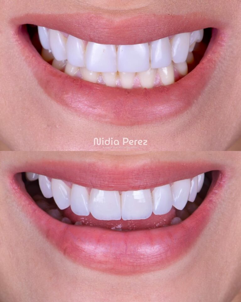 Instagram post from nidiaperezodontologa. This post is in position 5.