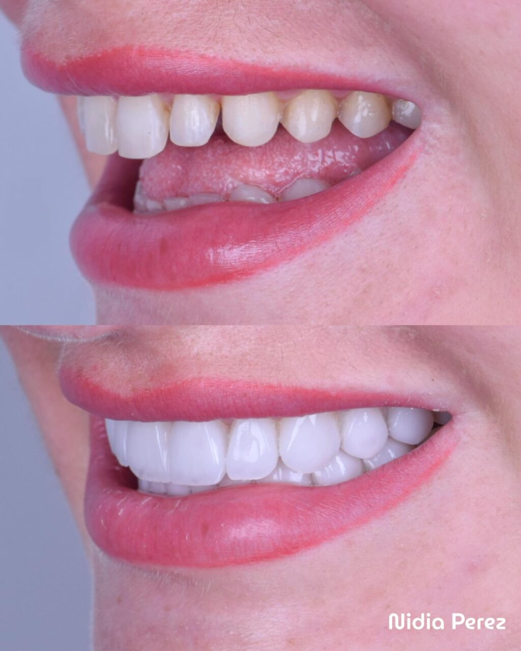 Instagram post from nidiaperezodontologa. This post is in position 2.